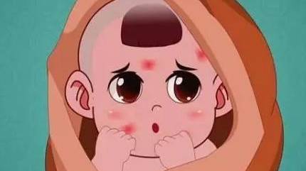 广州胎记医院治疗脸部红胎记疼吗