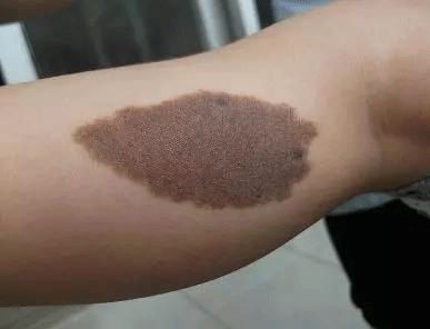 ȥ沿Ȱ